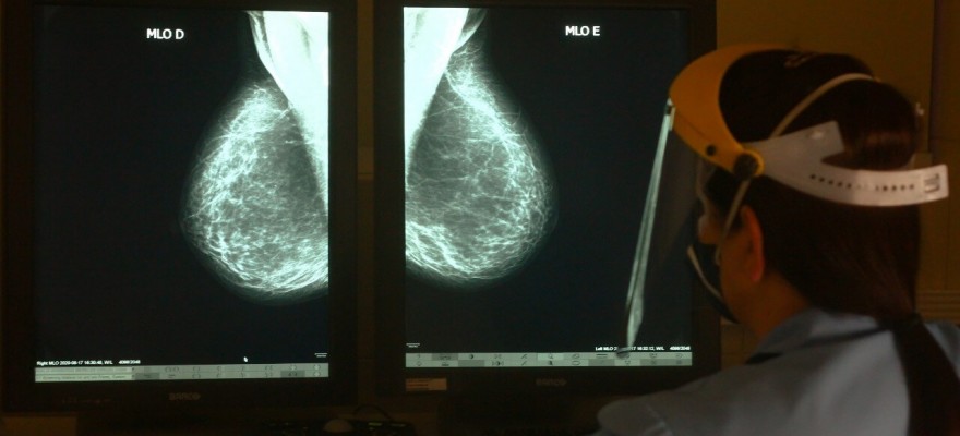 Exames de mamografias aumentam mais de 100% durante o Outubro Rosa